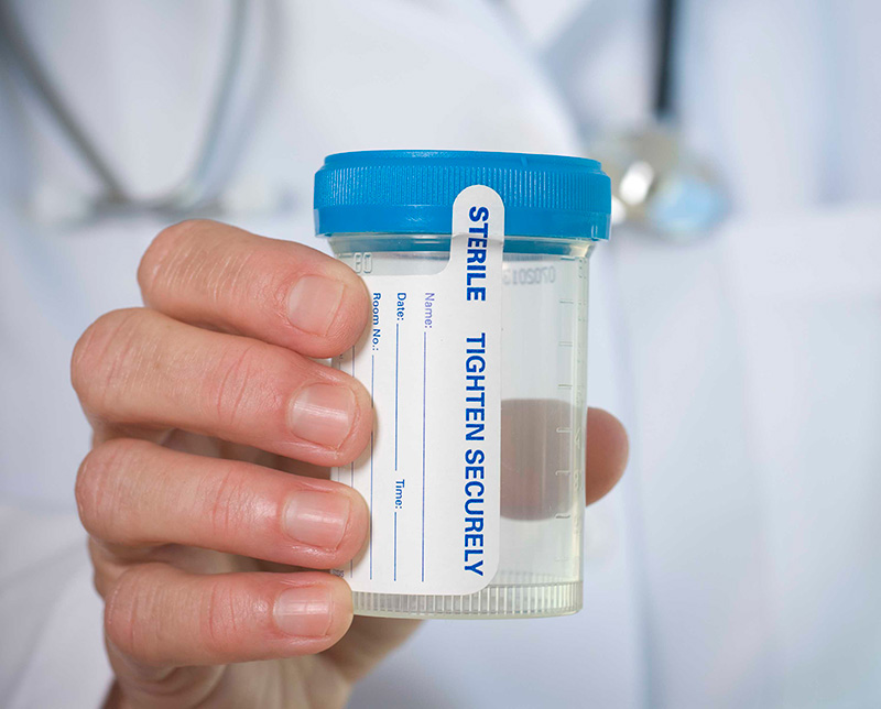 drug-testing